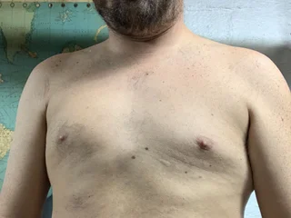 SexyFurryDadBod