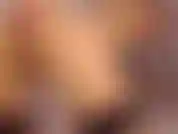 Anal 1 (pedo, prolapso, boquiabierto).