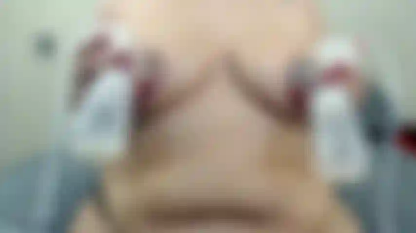 Sesión de extracción de leche materna.