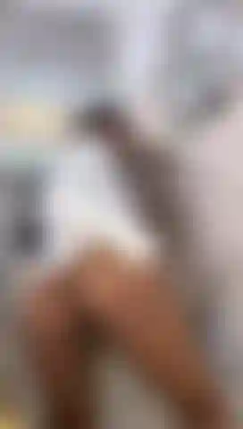 you will see my wounds open for you