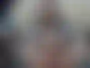 Jami se corre en su pie.